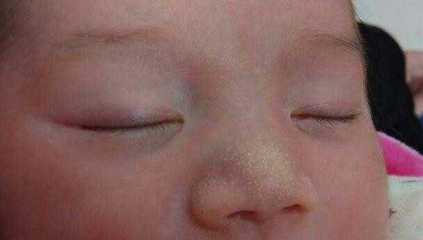 海南代生双胞胎 海南试管婴儿医院推荐 ‘四维彩超报告指标判断男女’